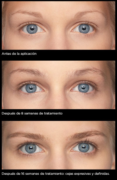 m2brows_antes-despues